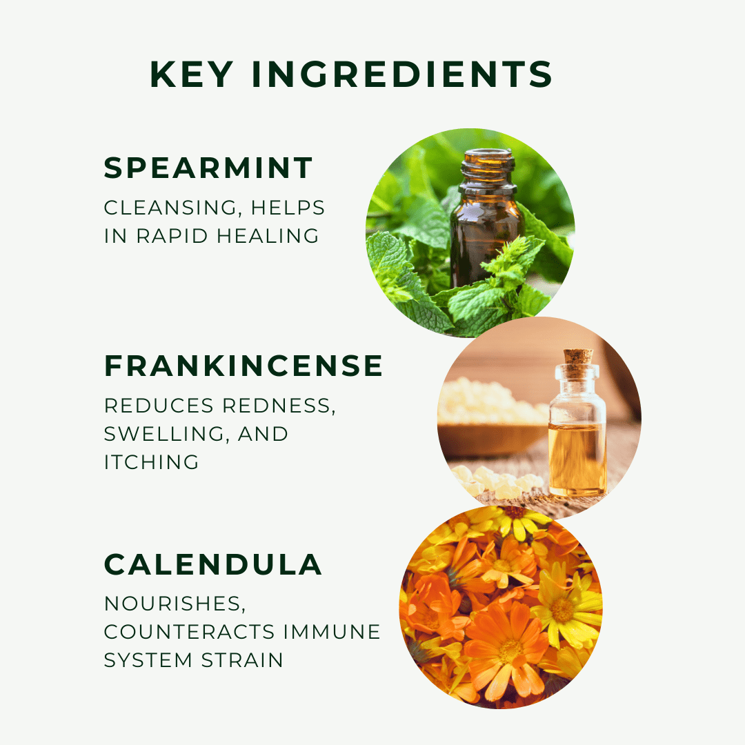 Eczema Scalp Oil w/Calendula - ALittlePeace