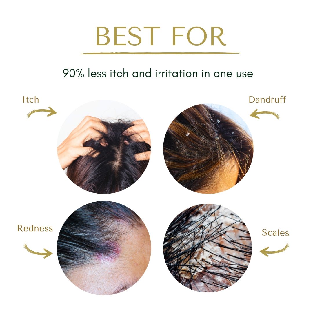 Eczema Scalp Treatment w/Tea Tree & Neem ALittlePeace